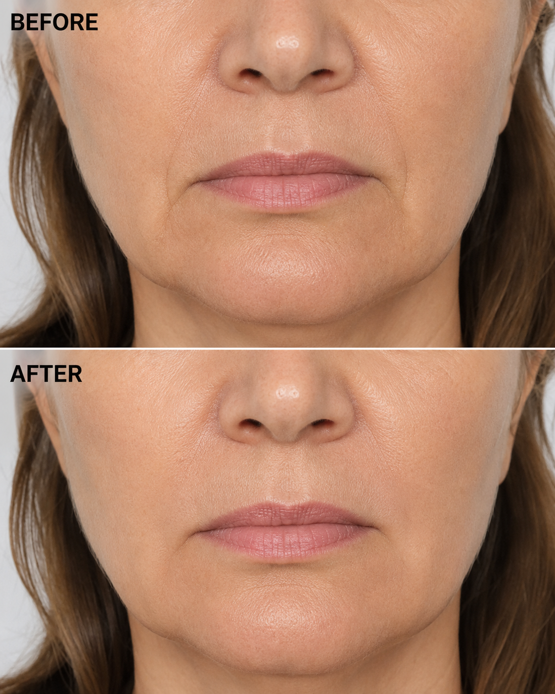 Marionette Lines — before and after